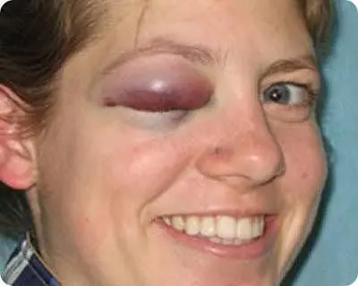 Increase in Wii Injury's during Christmas claims Telegraph