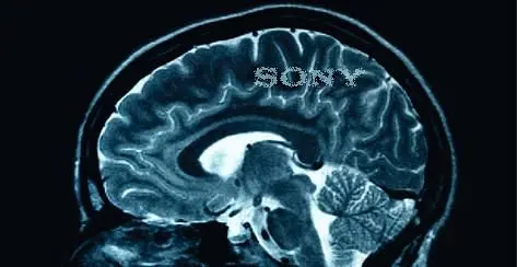 Fear not, "severe brain disorder" was really "PlayStation addiction"