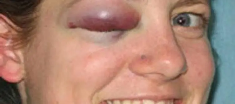 Increase in Wii Injury's during Christmas claims Telegraph
