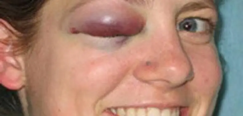 Increase in Wii Injury's during Christmas claims Telegraph