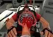 Surgeon Simulator 2013 gets free update, operate on Team Fortress 2's Heavy