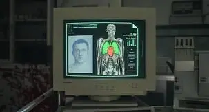 How to Open the Organ Transport Box in Resident Evil Requiem (Puzzle Solution)