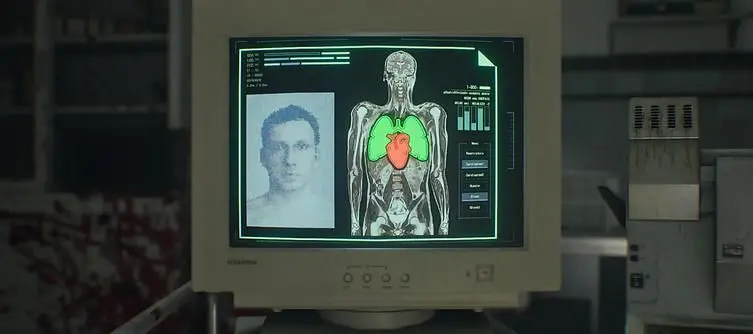 How to Open the Organ Transport Box in Resident Evil Requiem (Puzzle Solution)