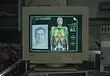 How to Open the Organ Transport Box in Resident Evil Requiem (Puzzle Solution)